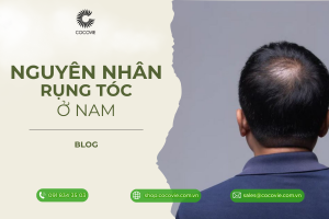 các nguyên nhân gây rụng tóc ở nam giới