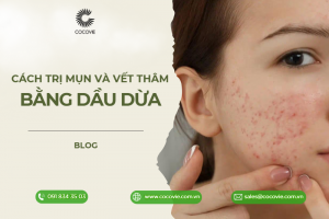 cách trị mụn và vết thâm bằng dầu dừa