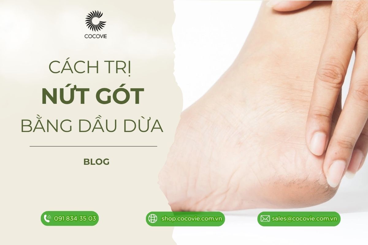 Test cách trị nứt gót chân bằng dầu dừa: top cách hiệu quả nhất?