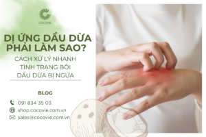 Dị ứng dầu dừa phải làm sao?
